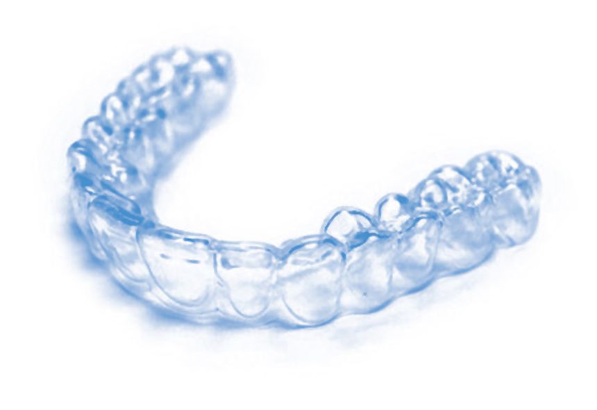 Co funzionëia pa les scines Invisalign ch’an ne vëiga (cuaji) nia?