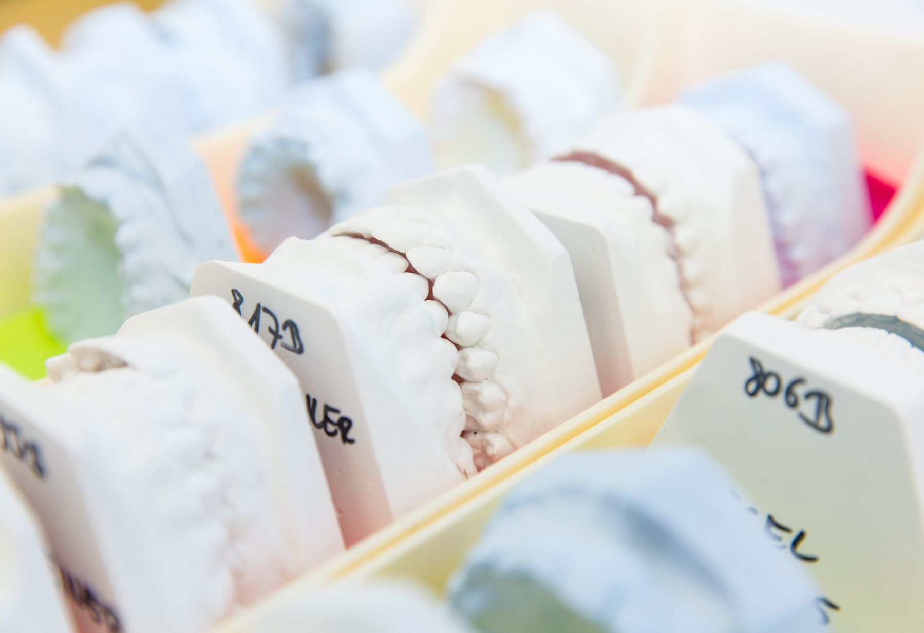 Spostamënc di dënz y di gramorins